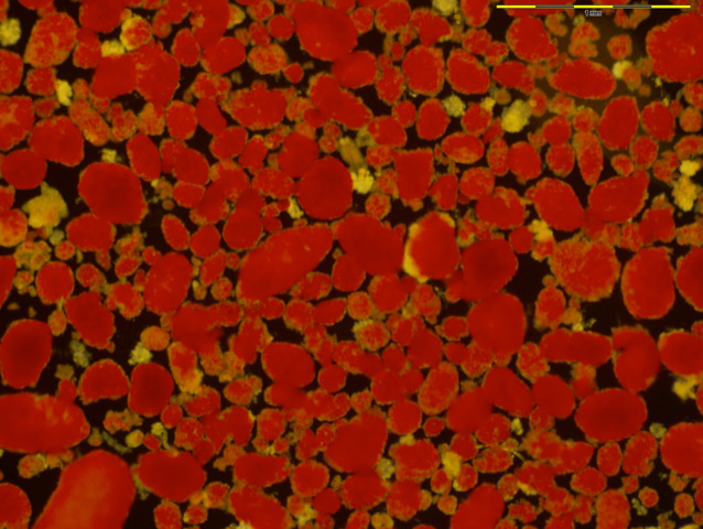 Human islets stained with dithizone