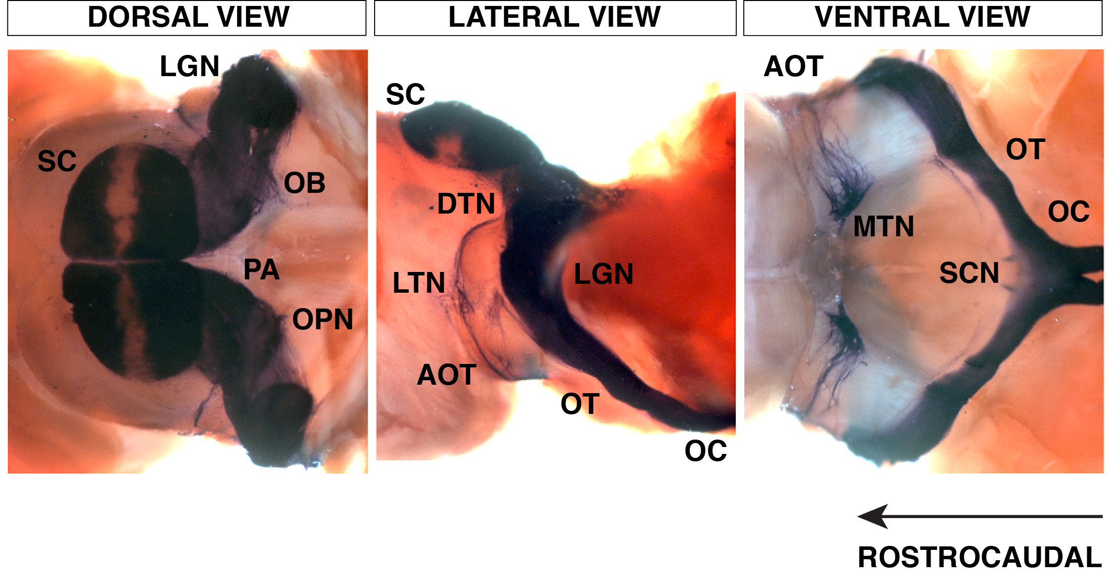 RGC axons innervating retinorecipient areas of the brain