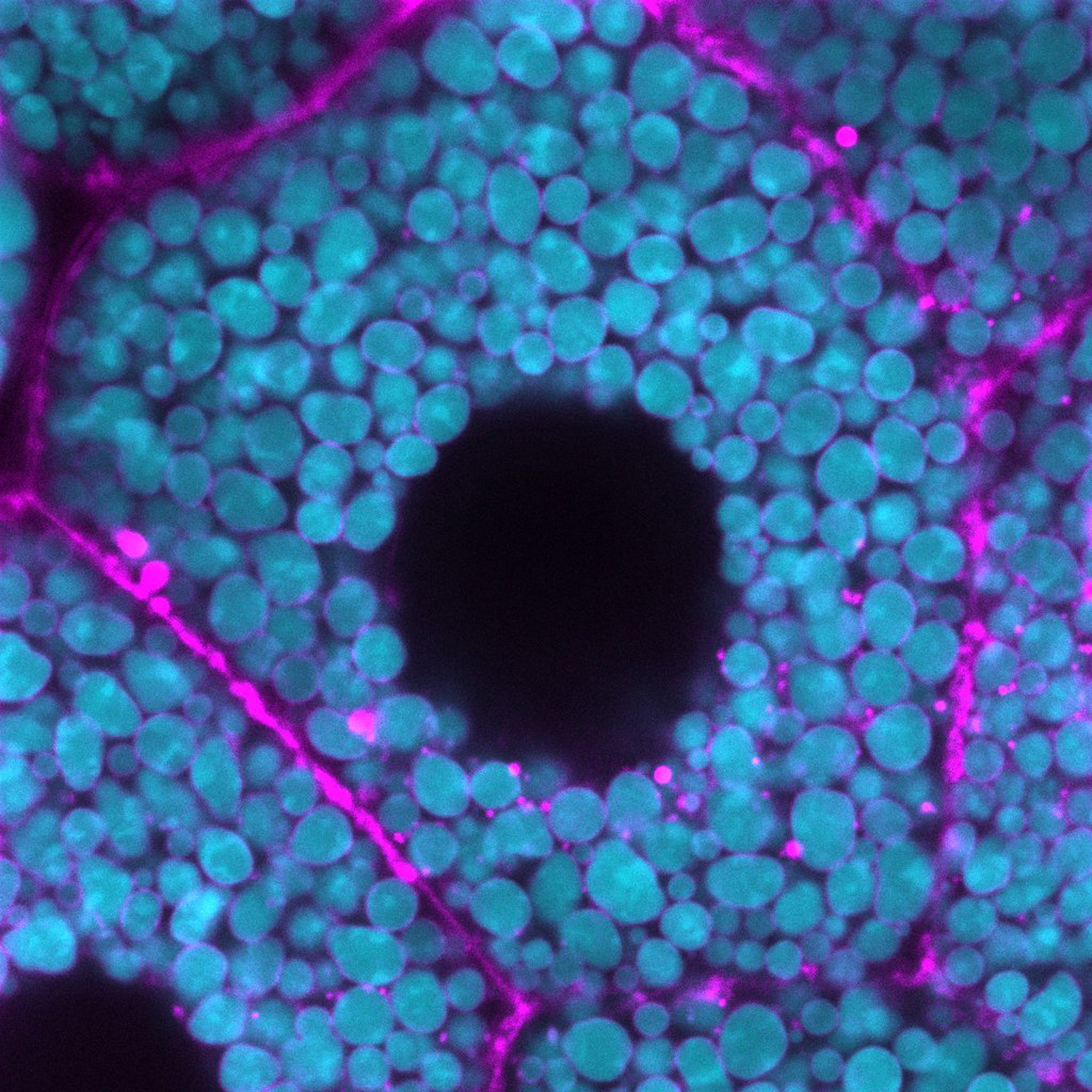 Mucin-containing secretory granules (turquoise) fusing with the apical membrane (pink).