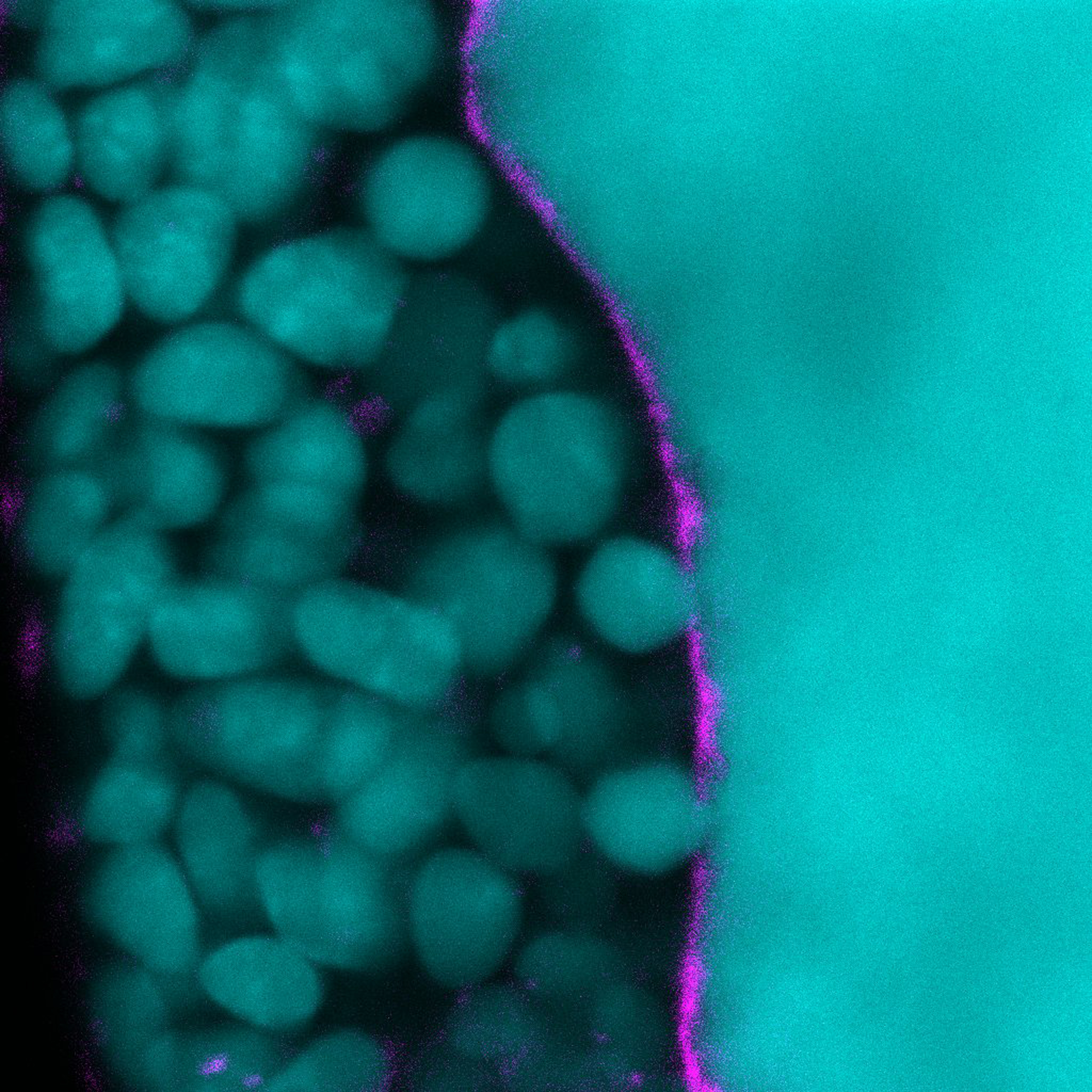 Loss of the protective peritrophic membrane results in epithelial expression of an IL-6 like cytokine, causing upregulation of JAK/STAT signaling (green) in cells that comprise the progenitor cell niche of the digestive tract in Drosophila.  JAK/STAT upregulation causes niche disruption and progenitor cell proliferation.  Nuclei are shown in blue.