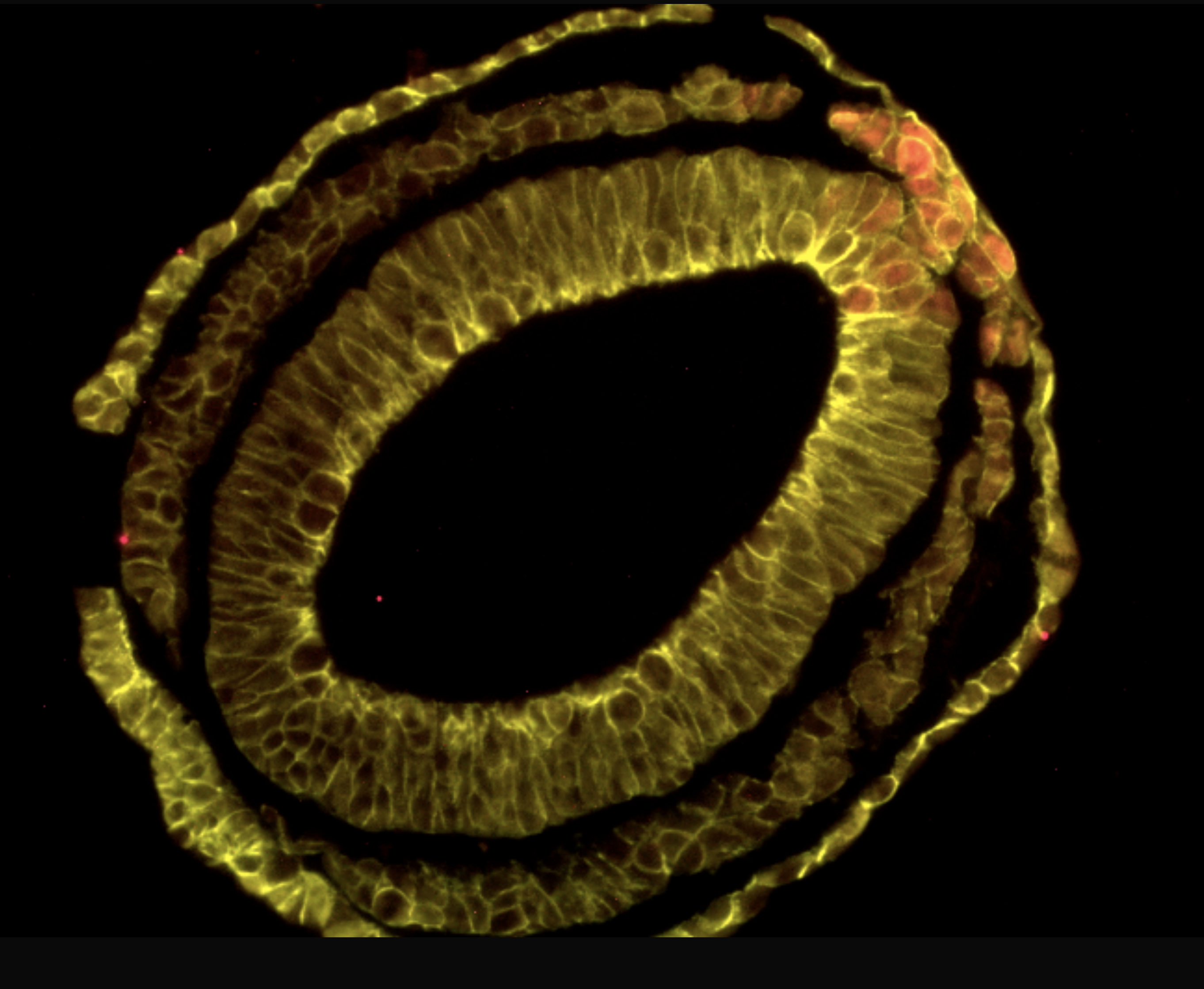 Section of a mouse embryo undergoing gastrulation