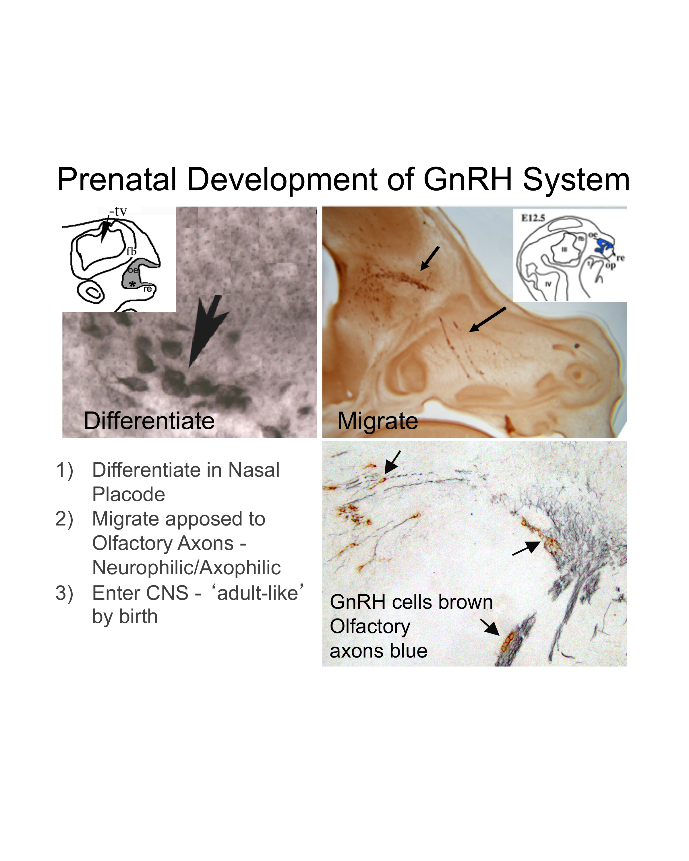Prenatal GnRH Development