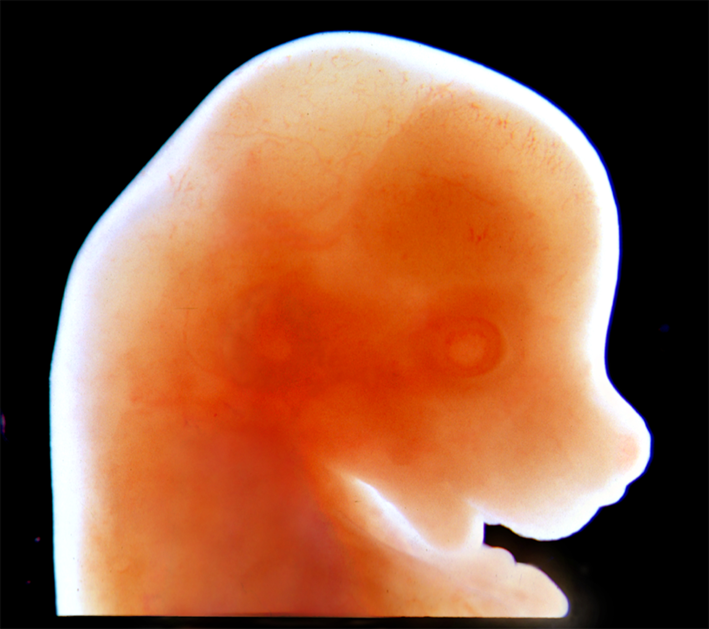 Mouse embryo craniofacial region in profile.