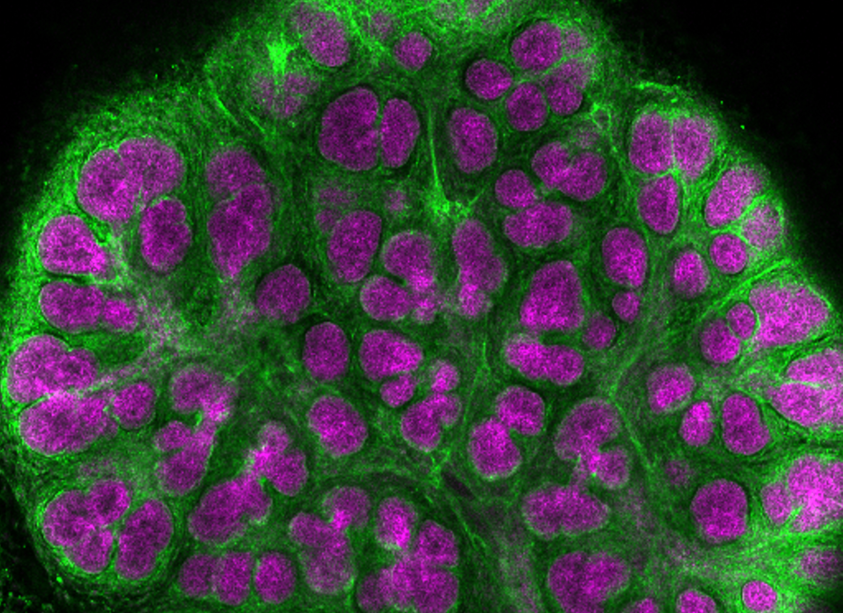 Embryonic mouse salivary gland immunofluorescence: magenta = E-cadherin and green = fibronectin.