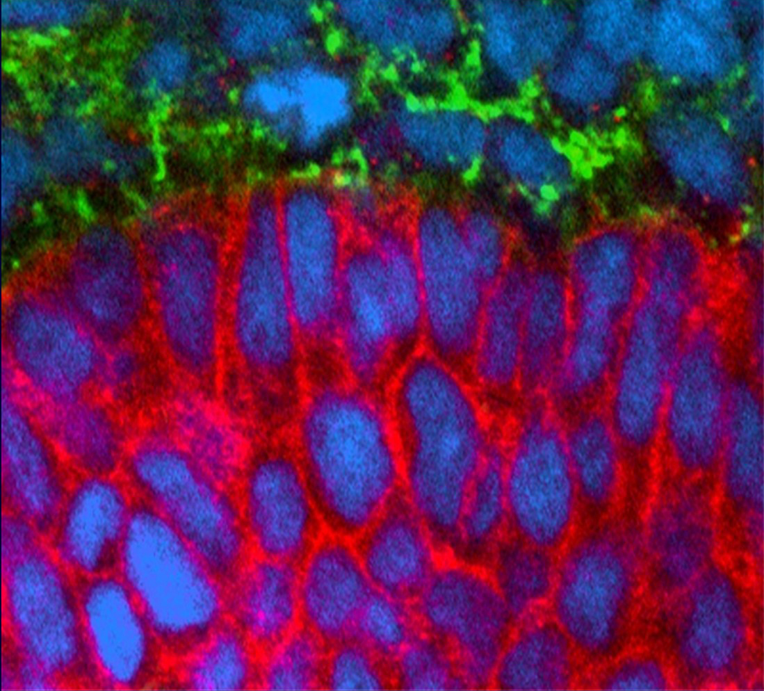 Mouse mesenchymal-epithelial interface: red = E-cadherin, green = fibronectin, and blue = nuclei.
