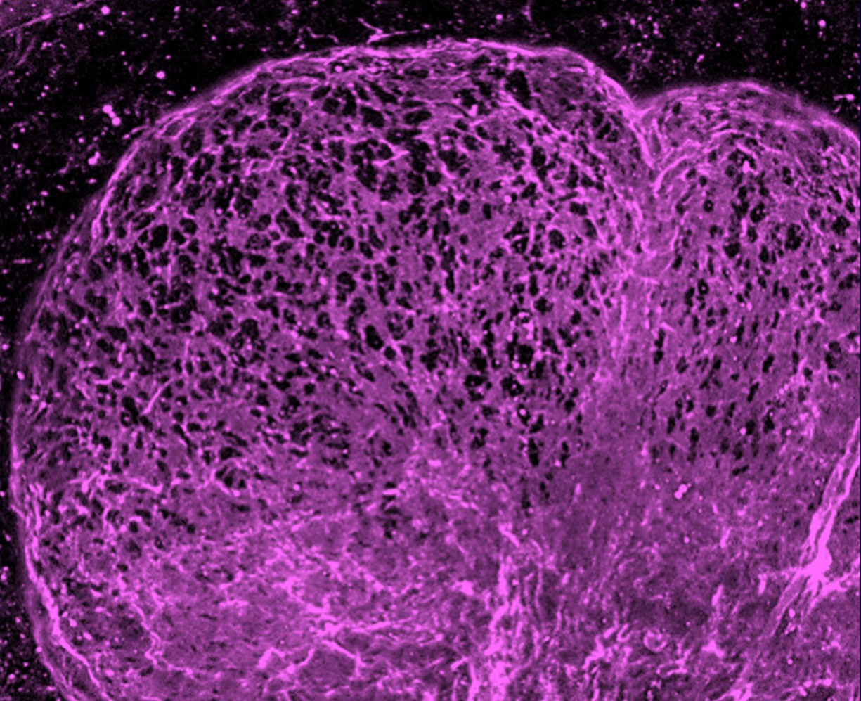 christmas party lab wing photoMicro-perforations (black) in mouse salivary gland epithelial basement membrane stained for collagen IV (magenta); note the numerous perforations concentrated at the tip of the expanding bud region (upper half of image).