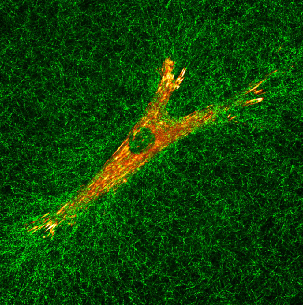 christmas party lab wing photoHuman fibroblast migrating in a 3D collagen gel: red = β1 integrin and green = collagen.